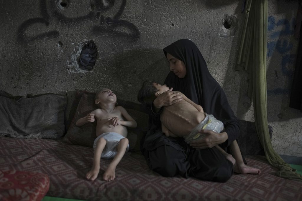 Aptopix mideast wars gaza starvation photo essay