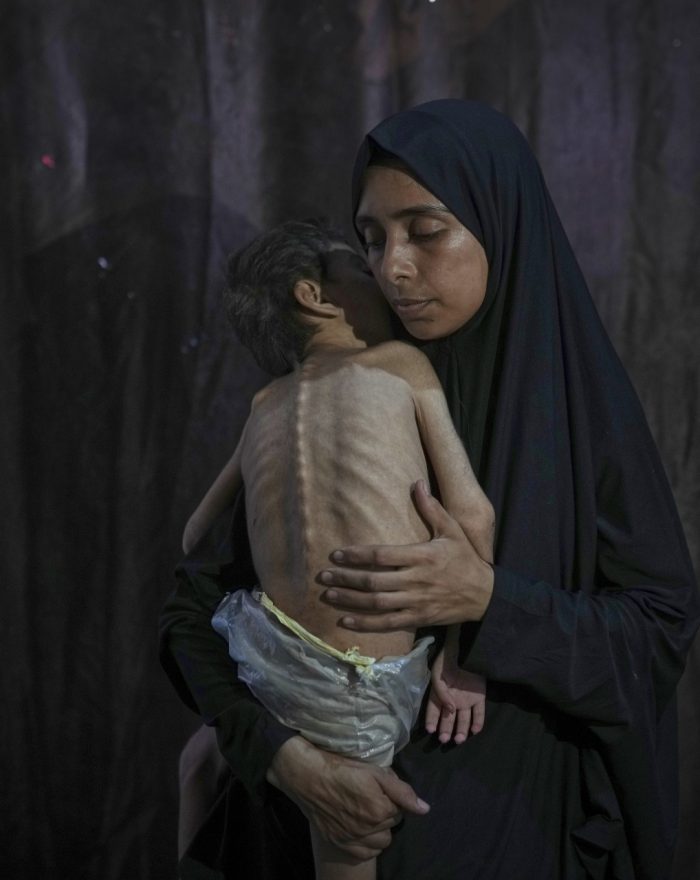 Mideast wars gaza starvation photo essay