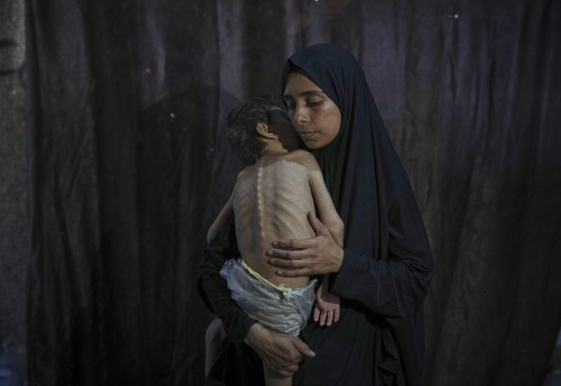 Mideast wars gaza starvation photo essay