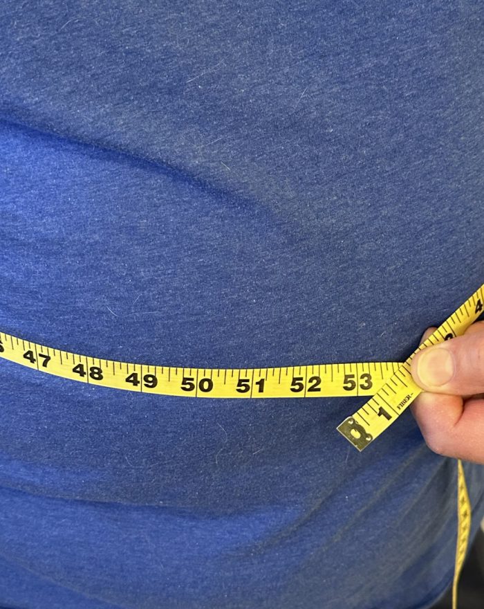 Obesity definition